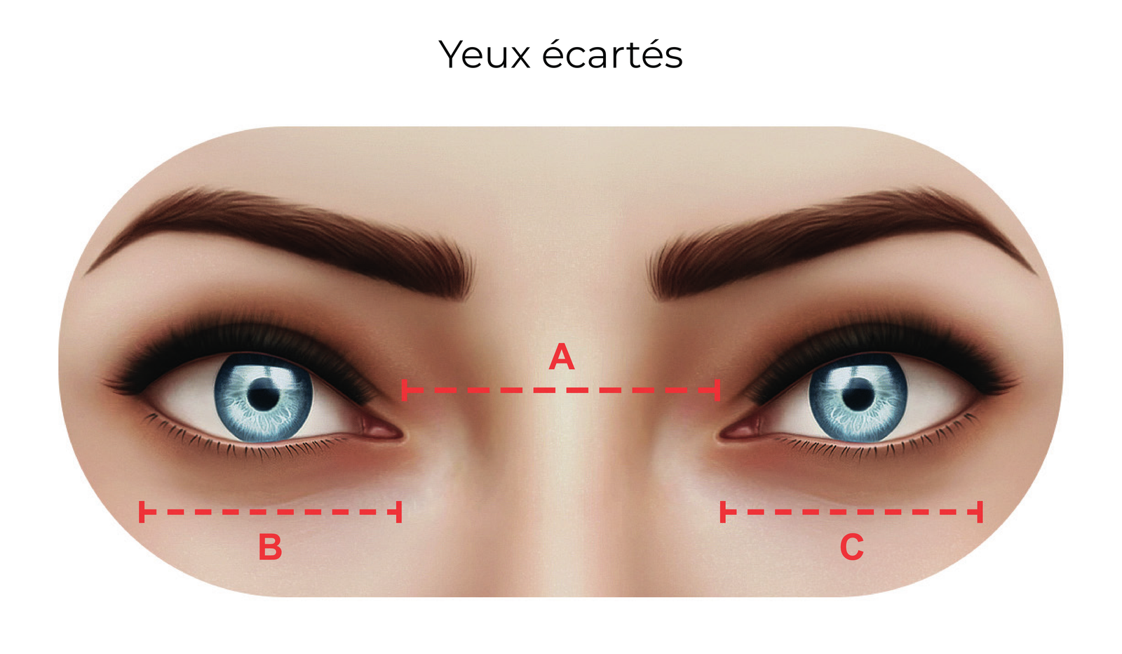 Yeux écartés