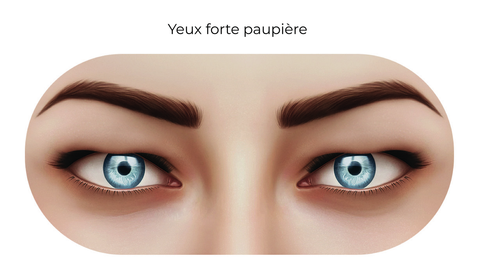 Yeux forte paupière