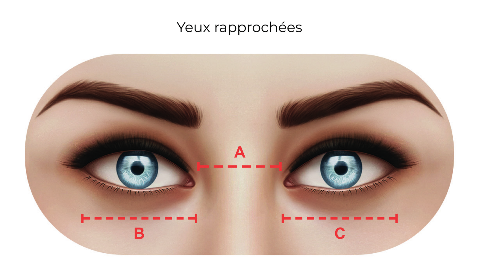 Yeux rapprochés