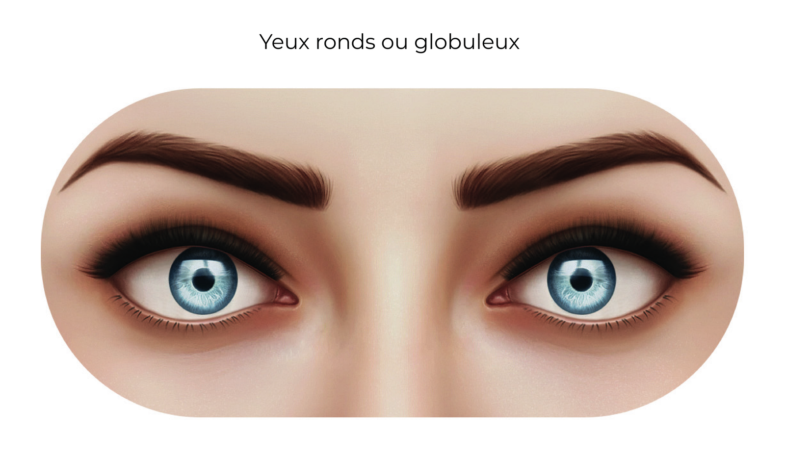 Yeux ronds ou globuleux